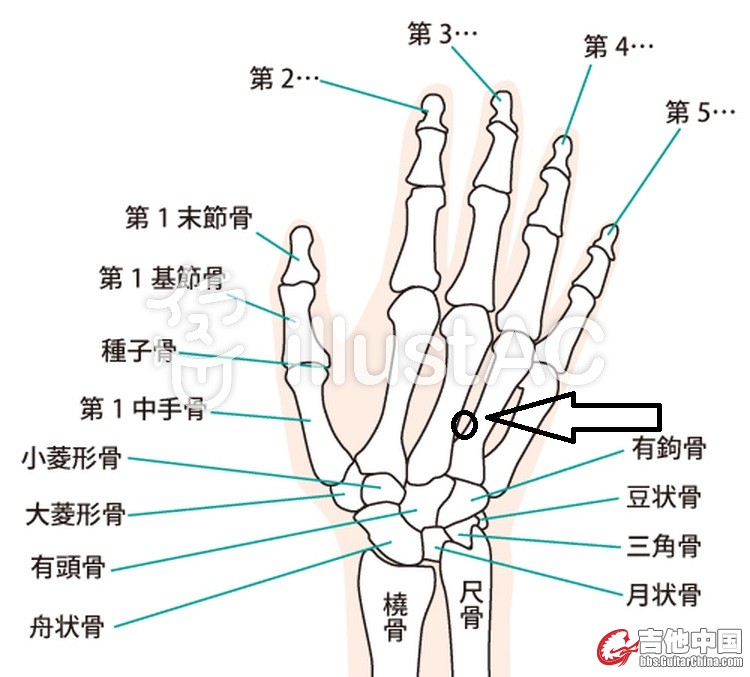 我的专业就是治疗洋人的痛症的。 来瞎说几句，合则用，不合就当笑话看看。 通常网络上很多酸民存在，因为大 ...