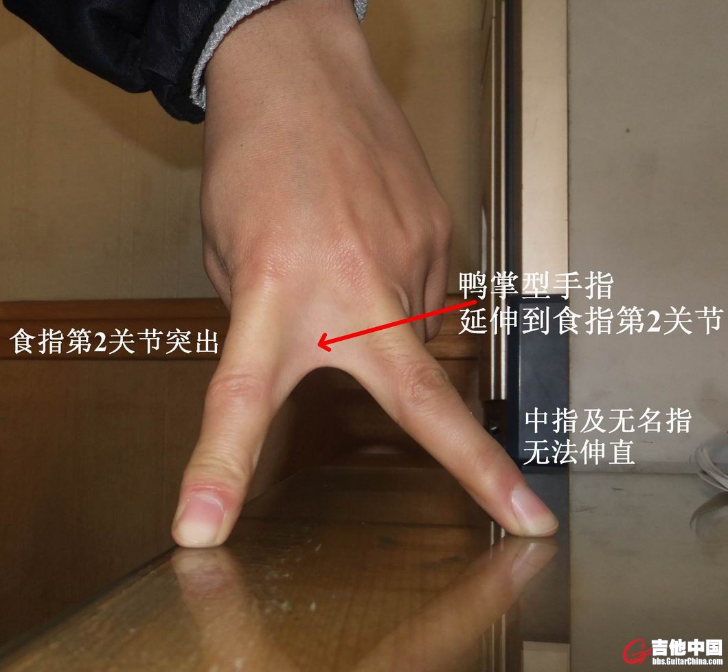 调整大小 finger01.jpg